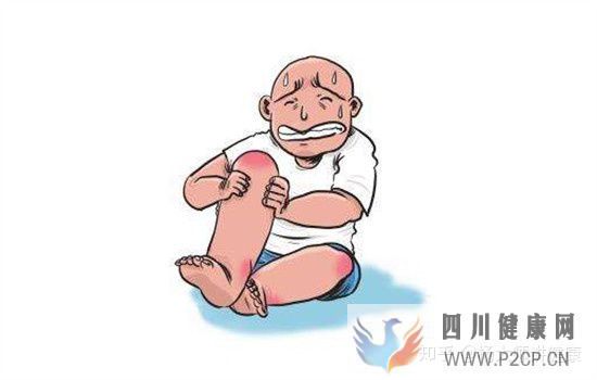 風濕病的早期癥狀有哪些7大癥狀要注意(圖6) 風濕病的早期癥狀有哪些7大癥狀要注意(圖6)