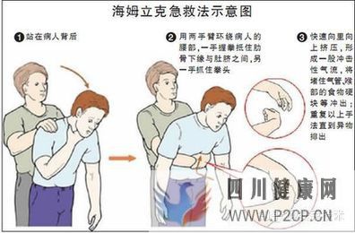 幾種常見的急救方法(圖3) 幾種常見的急救方法(圖3)