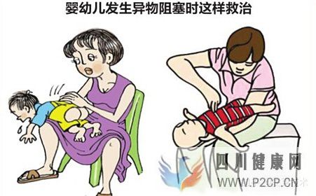 幾種常見的急救方法(圖7) 幾種常見的急救方法(圖7)