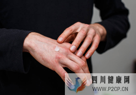 酒精過敏的癥狀有哪些?如何治療酒精過敏?(圖1) 酒精過敏的癥狀有哪些?如何治療酒精過敏?(圖1)