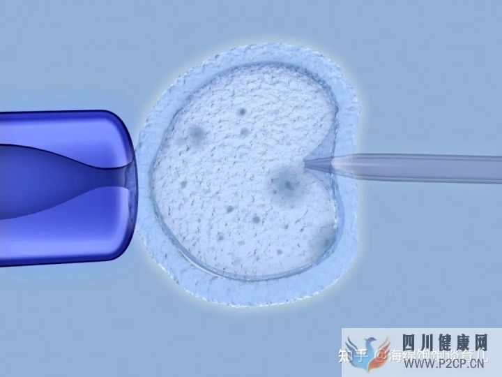 試管嬰兒1代、2代、3代、4代哪個最好真實操作過...(第二代試管嬰兒成功率有多少)(圖12) 試管嬰兒1代、2代、3代、4代哪個最好真實操作過...(第二代試管嬰兒成功率有多少)(圖12)
