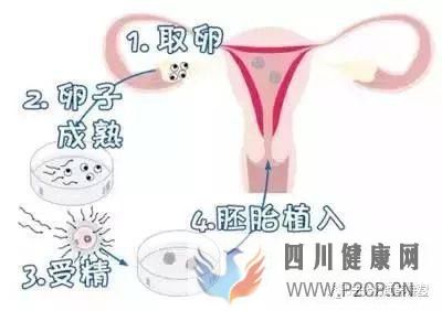 試管嬰兒的一個(gè)基本流程和周期時(shí)間(二代試管嬰兒需要多長(zhǎng)時(shí)間)(圖2) 試管嬰兒的一個(gè)基本流程和周期時(shí)間(二代試管嬰兒需要多長(zhǎng)時(shí)間)(圖2)