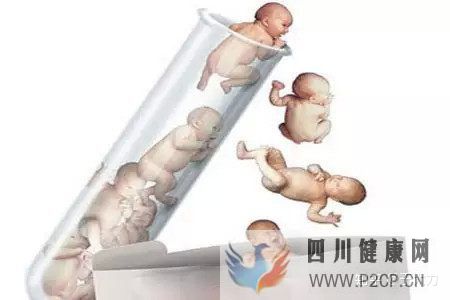 試管嬰兒的一個(gè)基本流程和周期時(shí)間(二代試管嬰兒需要多長(zhǎng)時(shí)間)(圖8) 試管嬰兒的一個(gè)基本流程和周期時(shí)間(二代試管嬰兒需要多長(zhǎng)時(shí)間)(圖8)