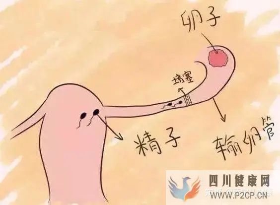 輸卵管不孕做試管嬰兒手術過程中,常見的六個問題(女方輸卵管堵塞做試管嬰兒需要多長時間)(圖2)