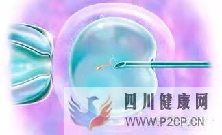 很多人說試管嬰兒可能不會是自己親生的,這是真的...(試管嬰兒90%不是自己的)(圖3) 很多人說試管嬰兒可能不會是自己親生的,這是真的...(試管嬰兒90%不是自己的)(圖3)