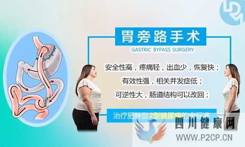 咨詢:胃旁路手術能治好糖尿病嗎?(圖1) 咨詢:胃旁路手術能治好糖尿病嗎?(圖1)