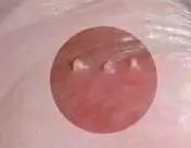 男科常見的幾種檢查項目,絕對認真!!!(圖10) 男科常見的幾種檢查項目,絕對認真!!!(圖10)