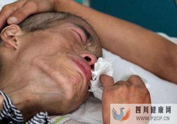 糖尿病癥狀早知道,7個(gè)征兆看出你是否有糖尿病,你都知道嗎?(圖1) 糖尿病癥狀早知道,7個(gè)征兆看出你是否有糖尿病,你都知道嗎?(圖1)