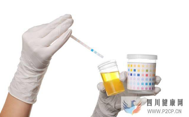 血常規和尿常規，能查出什么東西？文章一次給您講明白(圖1)