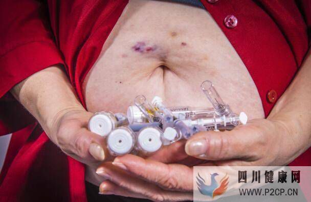 得了糖尿病，若出現(xiàn)這4個癥狀，你或已并發(fā)糖尿病腎病，需重視(圖1)