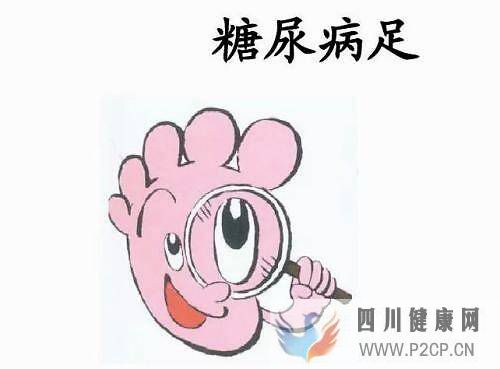 治療糖尿病出現的糖尿病足用什么方法可以不截肢？(圖1)