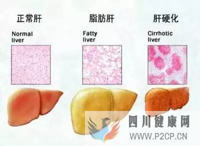 肝硬化的干細(xì)胞療法作用原理(干細(xì)胞的作用和價(jià)格表)(圖3)