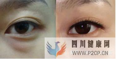 權威解析打干細胞美容的好處和壞處、打了干細胞臉...(干細胞對面部的重要作用)(圖8)