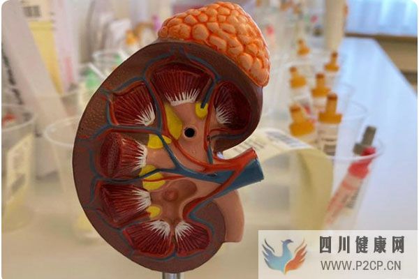 女子糖尿病腎病腎衰還能治好嗎？如何早發現微白蛋白？能吃水果嗎(圖3)