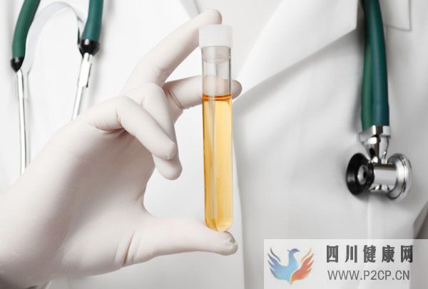 女子糖尿病腎病腎衰還能治好嗎？如何早發現微白蛋白？能吃水果嗎(圖4)