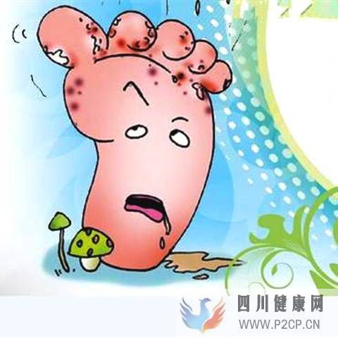 糖尿病患者腳潰爛有臭味怎么才能治療好？(圖1)