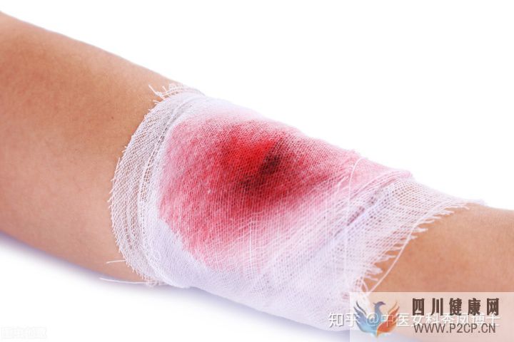 糖尿病的5大早期癥狀(圖3)