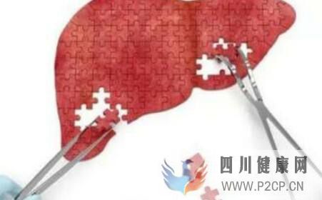 引起肝硬化的原因是什么(圖1) 引起肝硬化的原因是什么(圖1)