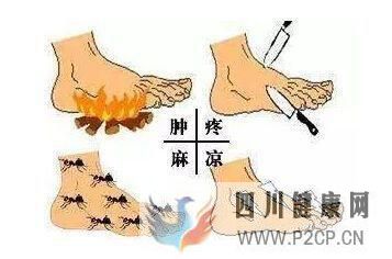 糖尿病下肢血管病變以后會出現什么癥狀？(圖1)