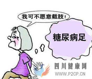 糖尿病出現(xiàn)的糖尿病足能保守不截肢治好嗎？(圖3)