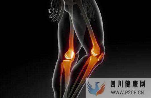 膝關節骨性關節炎的癥狀有哪些怎么治療比較好健康百科(圖1) 膝關節骨性關節炎的癥狀有哪些怎么治療比較好健康百科(圖1)