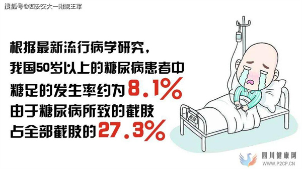 【就診指導(dǎo)】糖尿病足如何治療？(圖1)