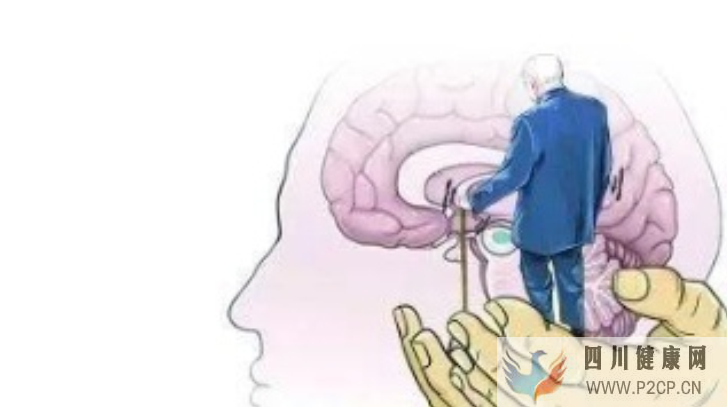 小腦萎縮都有哪些癥狀？要怎么治療？(圖1)