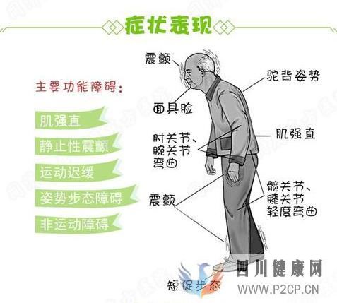 什么是震顫麻痹,震顫麻痹都有哪些癥狀,怎么樣治療?(圖1) 什么是震顫麻痹,震顫麻痹都有哪些癥狀,怎么樣治療?(圖1)