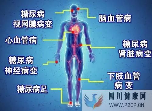 糖尿病患者容易出現(xiàn)哪些并發(fā)癥(圖1) 糖尿病患者容易出現(xiàn)哪些并發(fā)癥(圖1)