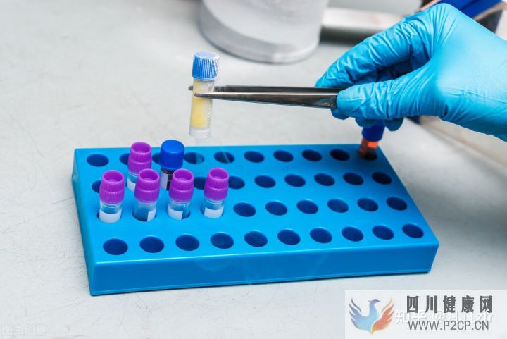 解密黑科技干細胞到底能不能打干細胞的副作用和...(圖15) 解密黑科技干細胞到底能不能打干細胞的副作用和...(圖15)