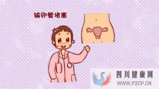 輸卵管堵塞也是分類型的(圖1) 輸卵管堵塞也是分類型的(圖1)
