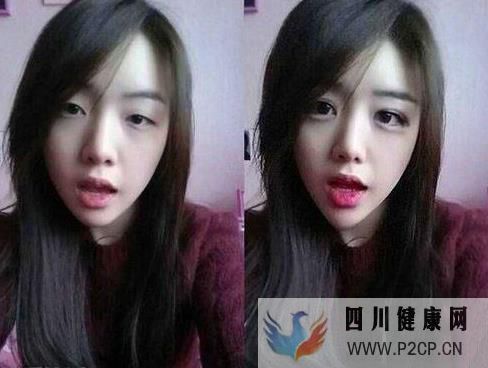 美容整形前一定要知道的美容整形知識(圖4) 美容整形前一定要知道的美容整形知識(圖4)