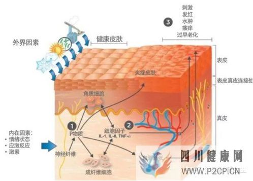 皮膚過敏,從原因到解決方案(圖13) 皮膚過敏,從原因到解決方案(圖13)