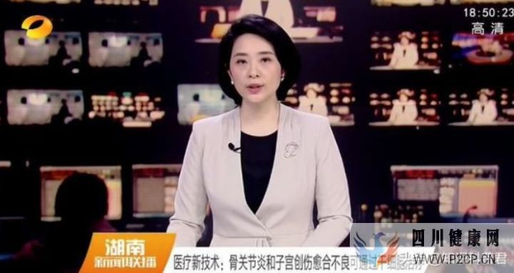 快訊干細胞治療骨關節炎最新臨床數據安全且有效(圖4) 快訊干細胞治療骨關節炎最新臨床數據安全且有效(圖4)