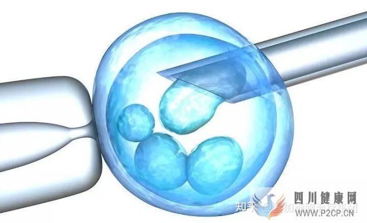 干細胞知多少回輸選第幾代多久見效自體還是異...(圖3) 干細胞知多少回輸選第幾代多久見效自體還是異...(圖3)