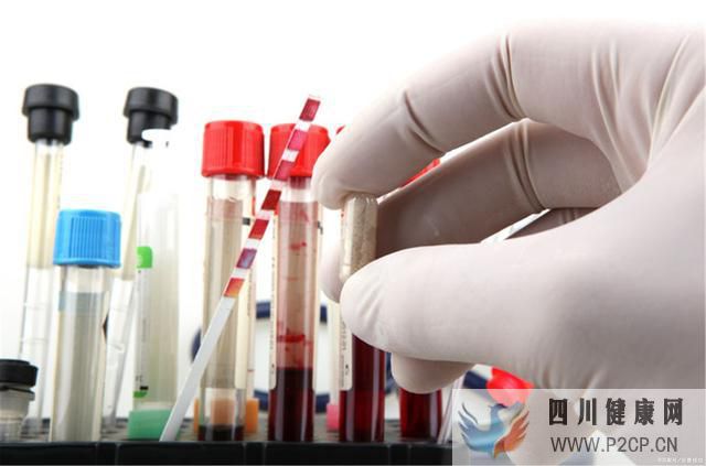 男子糖尿病腎病肌酐高過千,中醫降肌酐停透析康復,中醫治療方法(圖1) 男子糖尿病腎病肌酐高過千,中醫降肌酐停透析康復,中醫治療方法(圖1)