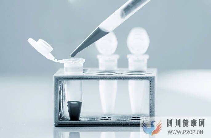 干細(xì)胞療法治療糖尿病需要多少錢？王志華博士(圖1)