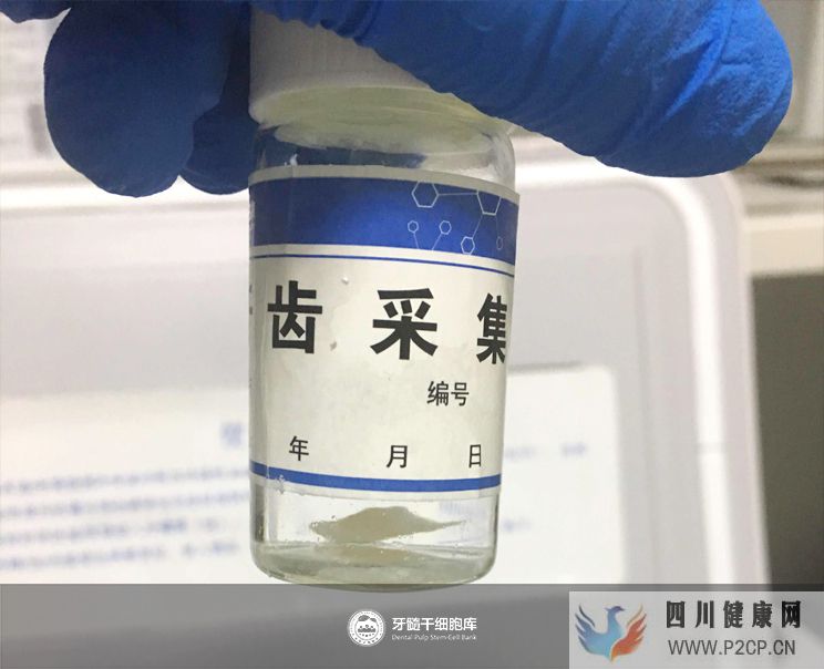 牙髓干細胞采集方法是什么，去哪里儲存？(圖2)