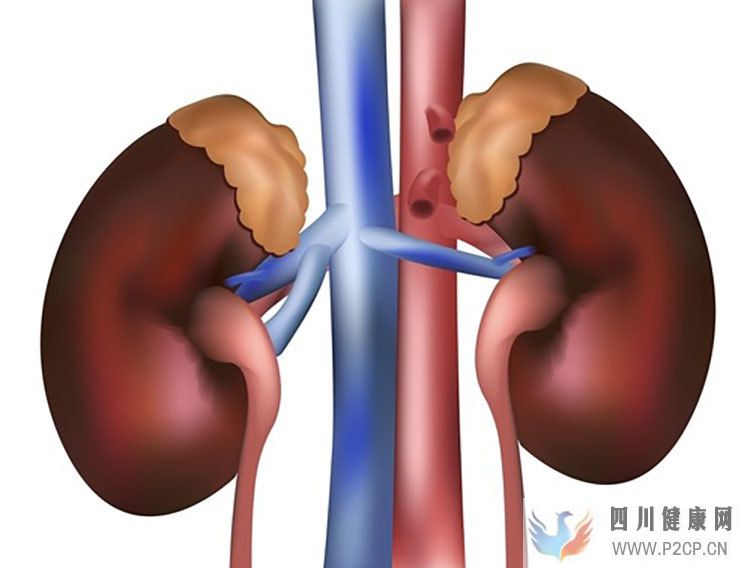 慢性腎臟病腎功能不全的概述及導(dǎo)致問題日本干細(xì)胞如何治療(圖1) 慢性腎臟病腎功能不全的概述及導(dǎo)致問題日本干細(xì)胞如何治療(圖1)
